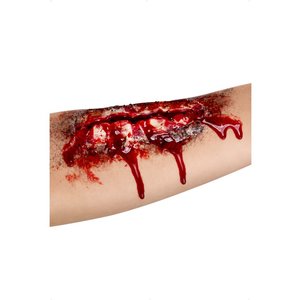 Skada - öppet sår arm