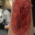 Sår där jag använt flytande latex och sprayblod från zingland